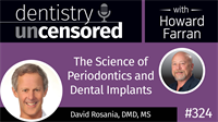 324 The Science of Periodontics and Dental Implants with David Rosania : Dentistry Uncensored
