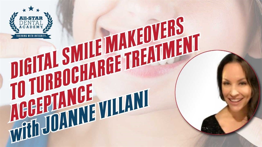 Digital Smile Makeovers to Turbocharge Treatment Acceptance with Joanne Villani 