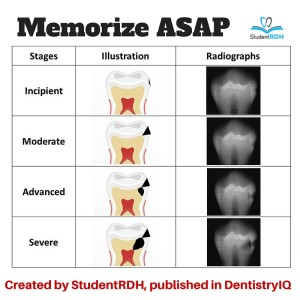 Must-Know Classifications Of Dental Caries For The National Dental Hygiene Boards