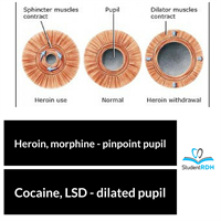 All of the following drugs create pupil dilation except?