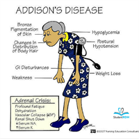 What disease is related to adrenal insufficiency?