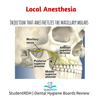 Which injection anesthetizes the maxillary posterior teeth?