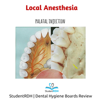 Which injection anesthetizes the palatal tissues around the left maxillary molar?
