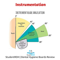Q: The optimal blade angulation for the removal of deposits is: