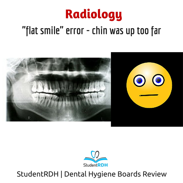 Q: Which radiographic error caused this “flat” smile?
