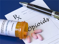 Opioid Prescription: 4 Things Dentists Should Know