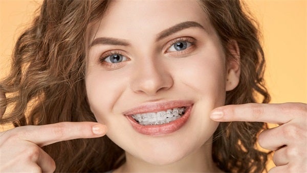 How to Take Care of Your Braces and Avoid Mistakes